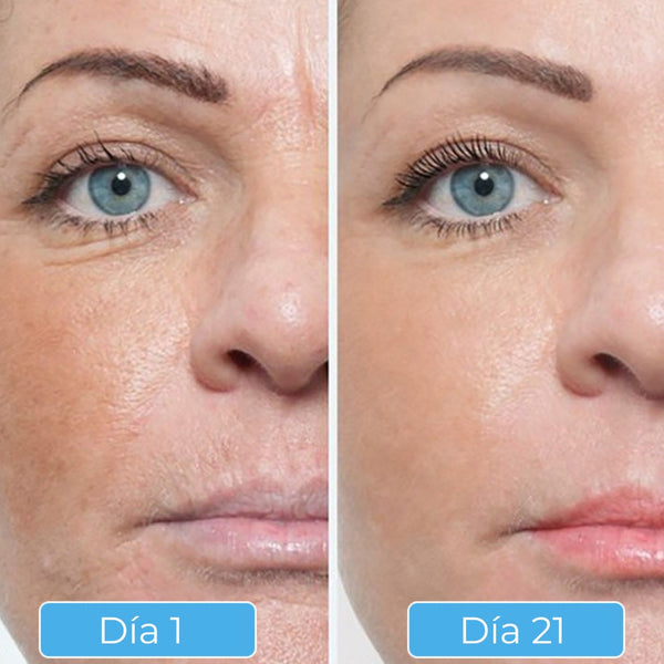 Glowskin Pro® - Máscara LED Antiedad