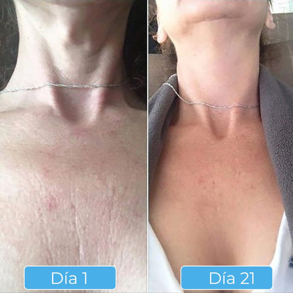 Glowskin Pro® - Máscara LED Antiedad